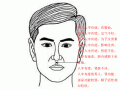 人中有痣的男人命好吗