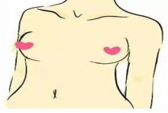 女人胸部有痣代表什么